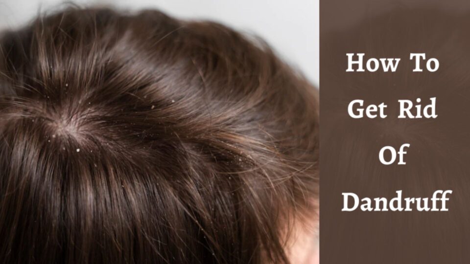 Get Rid of Dandruff